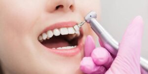 Teeth Whitening Treatments in North York